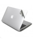 Виниловaя наклейка для клавиатуры MacBook Air 13 | Pro 13 с Собственным Дизайном
